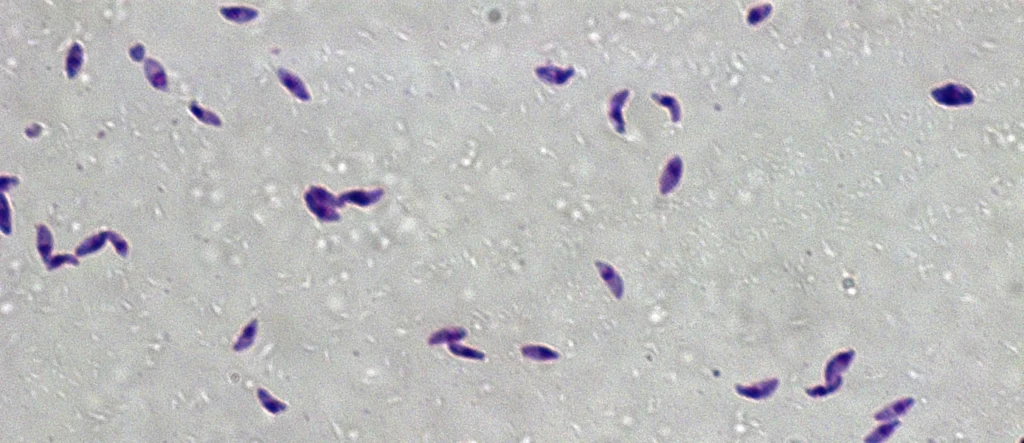 toksoplazmoza
