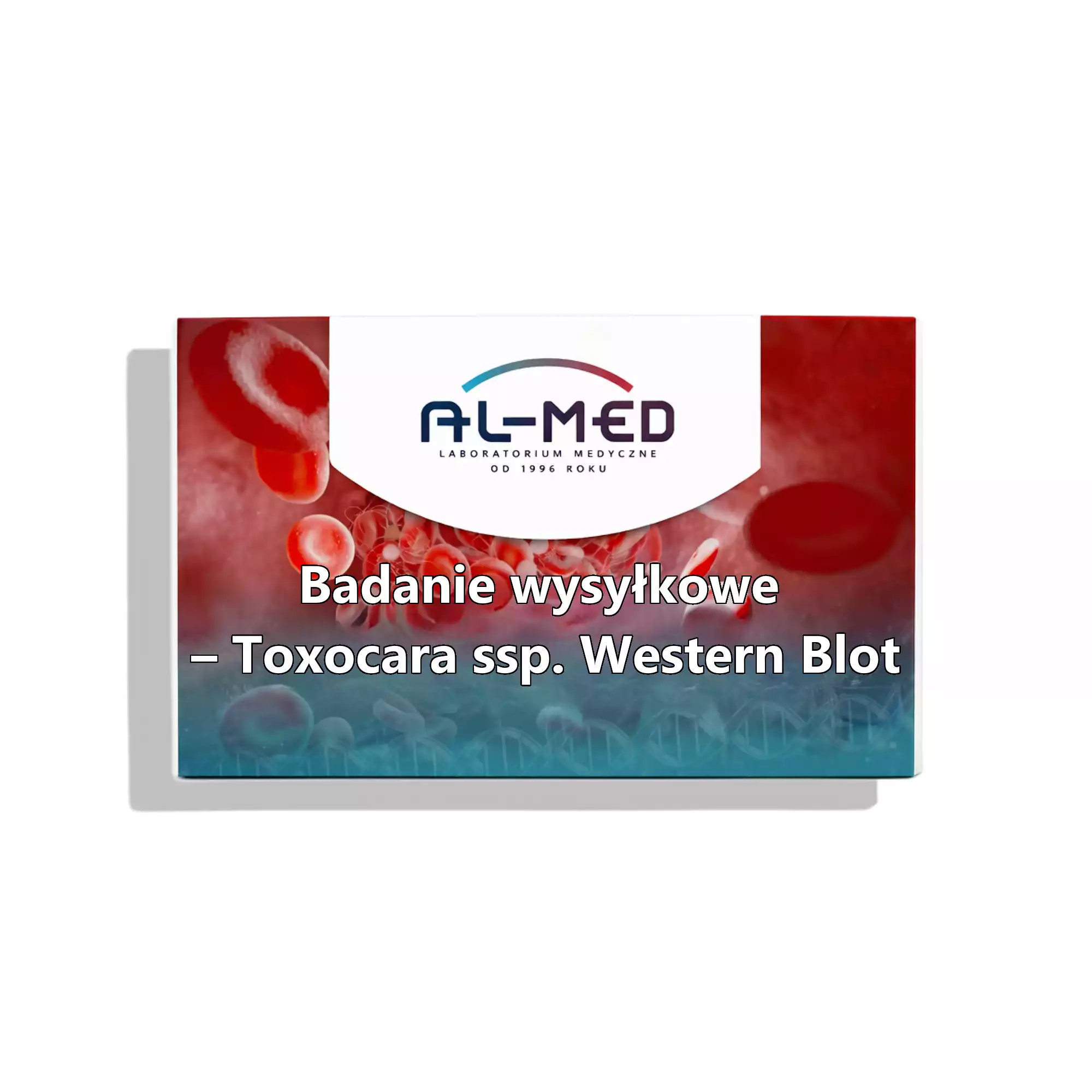 Badanie wysyłkowe – Toxocara ssp. Western Blot